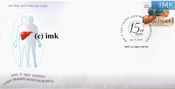 India 2014 Liver Transplantation (Fdc)